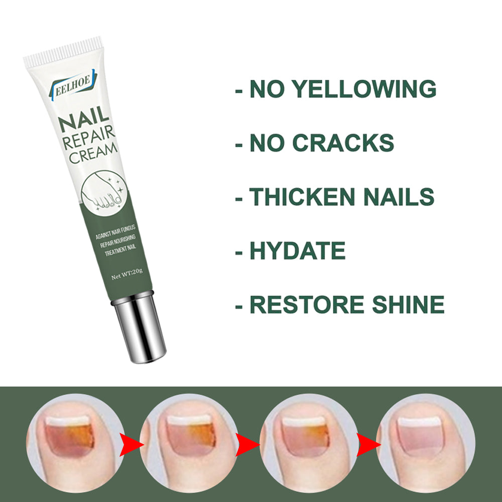 Foot Care And Thickening Nail Repair Cream. Nail Repair Cream - V.I.P Digital Presence