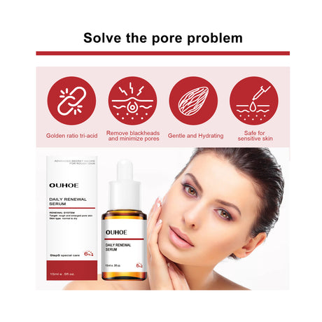 Mandelic Acid Daily Update Essence, Acne-Removing And Acne-Closing Repair Brightening Fruit Acid Essence - V.I.P Digital Presence