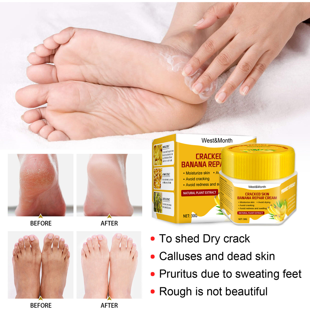 Cracked Skin Banana Repair Cream, Nourishing And Moisturizing Foot Repair Cream To Soften Exfoliation And Remove Dead Skin Calluses - V.I.P Digital Presence