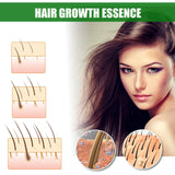 Ginger Hair Growth Spray, Nourishing And Nourishing Hair Root, Hair Care Solution To Prevent Scalp Loss - V.I.P Digital Presence
