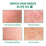 Tea Tree Oil Acne Serum, Remove Acne, Clear Acne, Repair Skin, Lighten Acne Printing Face Essence - V.I.P Digital Presence