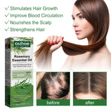 Rosemary Hair Dense Essential Oil, Prevent Hair Breakage And Hair Loss Strong, Strong And Solid Hair Moisturizing Root Dense Essential Oil - V.I.P Digital Presence