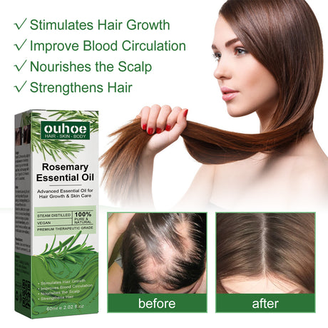 Rosemary Hair Dense Essential Oil, Prevent Hair Breakage And Hair Loss Strong, Strong And Solid Hair Moisturizing Root Dense Essential Oil - V.I.P Digital Presence