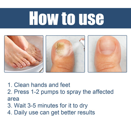 Nail Care Spray Gently Cleans Foot Nails Moisturizing And Brightening Nail Care Spray - V.I.P Digital Presence