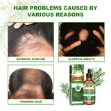 Rosemary Essential Oil Hydrates And Moisturizes Damaged Hair, Strengthens Hair And Softens Hair Care Essential Oil - V.I.P Digital Presence