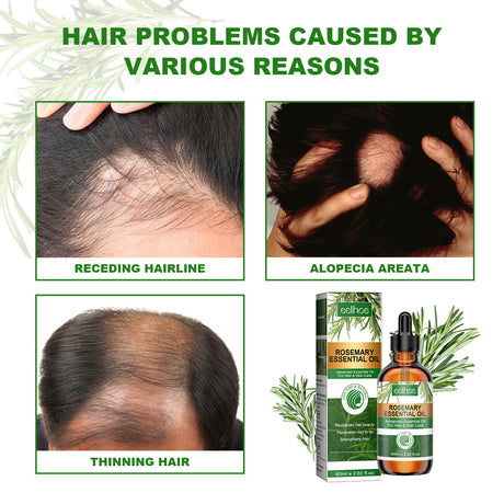 Rosemary Essential Oil Hydrates And Moisturizes Damaged Hair, Strengthens Hair And Softens Hair Care Essential Oil - V.I.P Digital Presence