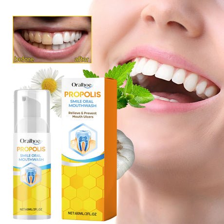 Propolis Oral Cleaning Mousse Oral Cleaning Care Tooth Stain Removal Fresh Mousse Toothpaste - V.I.P Digital Presence