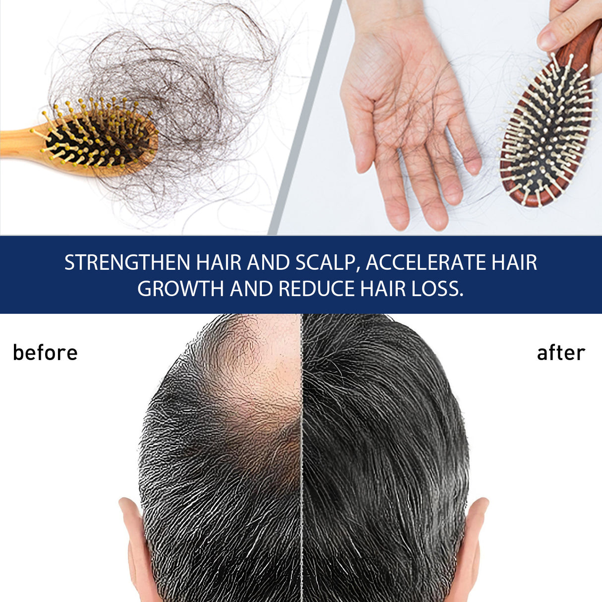 Alopecias Hair Growth Cream, Protect Hair Follicles Strong Moisturizing Thick Hairline Hair - V.I.P Digital Presence