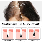 Hair Essence, Repair Dry Hair, Moisturize Hair Roots And Scalp Hair Essence - V.I.P Digital Presence