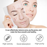 Herbal Acne Serum, Reduce Acne Pimples With A Comprehensive Moisturizing Moisturizer - V.I.P Digital Presence