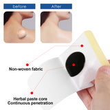 Lipoma Removal Patch, Soothing Various Body Fat Knots To Remove Subcutaneous Lumps Care Patch - V.I.P Digital Presence