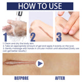 Scar Gel, Fade Skin Scar Pregnancy Surgery Scar Moisturizing Skin Care Gel - V.I.P Digital Presence