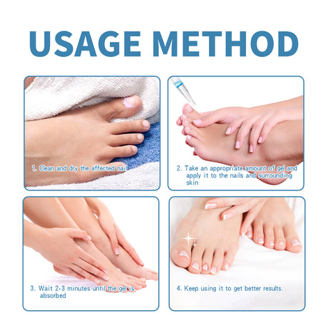 Anti-Paronychia Nail Repairing Gel, Repair Encased Rotten Nails Soft Nails Thickening Pain Relief Cleansing Care - V.I.P Digital Presence