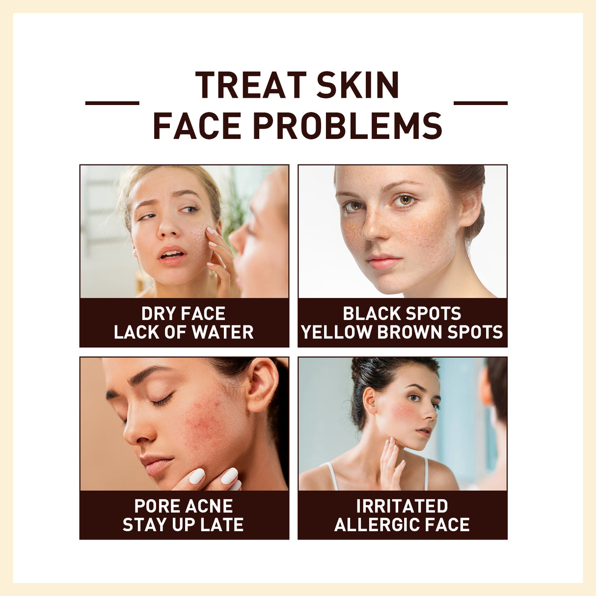 Rice Anti Wrinkle Essence, Repairs Skin Moisturizes Firms Whitens Essence - V.I.P Digital Presence