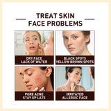 Rice Anti Wrinkle Essence, Repairs Skin Moisturizes Firms Whitens Essence - V.I.P Digital Presence