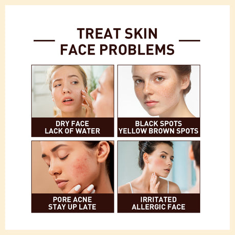 Rice Anti Wrinkle Essence, Repairs Skin Moisturizes Firms Whitens Essence - V.I.P Digital Presence