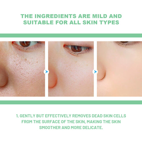 Exfoliating Gel, Mildly Clean Silent Black Mouth Contractive Pore Chamfer Bright Skin Gel - V.I.P Digital Presence