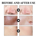 West & Month Blackhead Remove Solid Mud Film Refreshing Skin Cleaning Face Mask Moisturize Control Oil Shrink Pores Skin Care - V.I.P Digital Presence