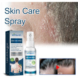 Cowhide Moss Repair Spray Relieves Redness And Itchy Scalp Skin Repair Spray - V.I.P Digital Presence
