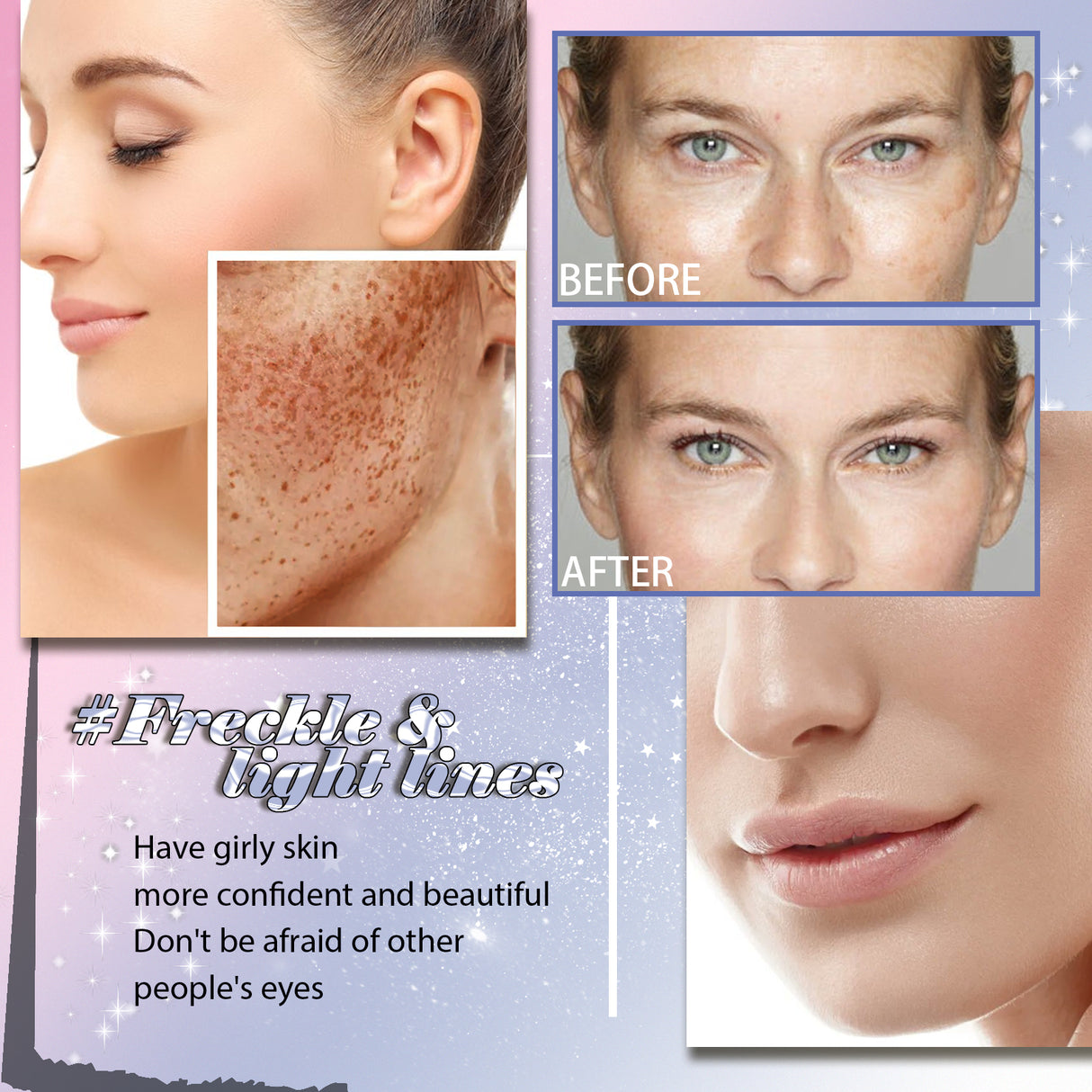 Freckle Removing Anti-aging Essence, Facial Firming Anti-wrinkle Lightening Melasma Stain Nourishing Skin Essence - V.I.P Digital Presence