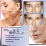 Freckle Removing Anti-aging Essence, Facial Firming Anti-wrinkle Lightening Melasma Stain Nourishing Skin Essence - V.I.P Digital Presence