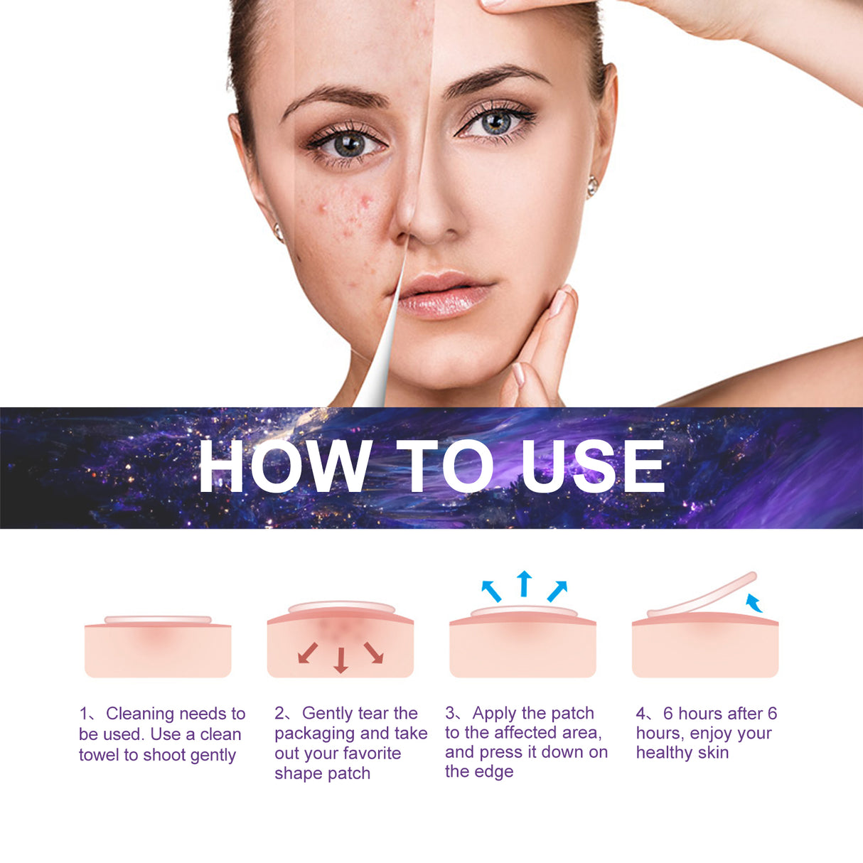 Acne Patch, Fade Closed Mouth Acne, Clear Acne, Waterproof Breathable Repair Acne Muscle Pattern Acne Patch