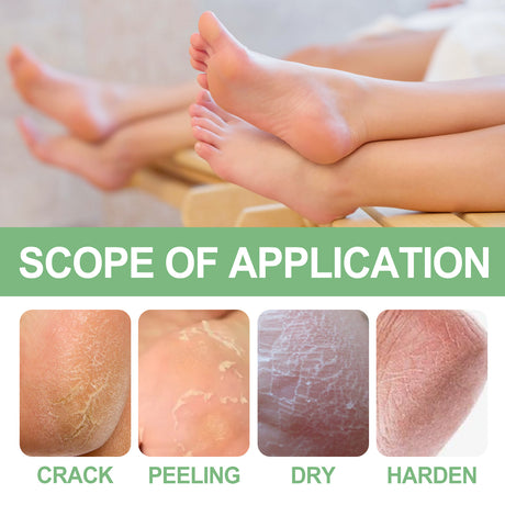 Peppermint Foot Cream, Repair The Foot Prevent Weather-Shack Desquamate Cracked Heels Moisturize Foot Care Cream - V.I.P Digital Presence