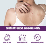 Body Cleansing Gel For Back Acne Cleansing Clay Scrub