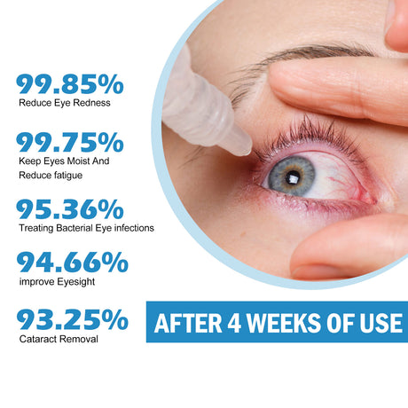 Eye Drops Dryness Soothing, Relieve Eye Fatigue, Dry Eyes, Red Eyes, Blurred Vision Eyes Care Lotion - V.I.P Digital Presence