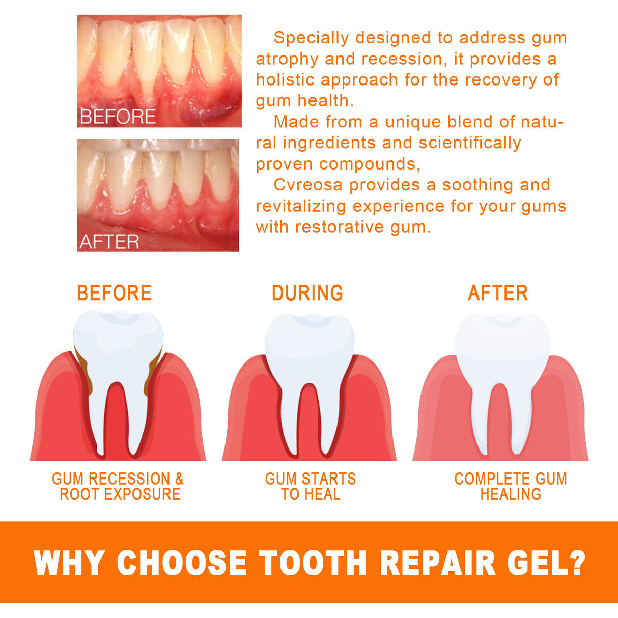 Tooth Repair Essence, Cleaning Teeth Stains Tartar Care Gums Oral Care Essence - V.I.P Digital Presence