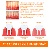 Tooth Repair Essence, Cleaning Teeth Stains Tartar Care Gums Oral Care Essence - V.I.P Digital Presence
