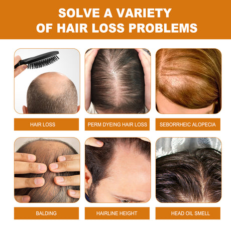 Rice Dense Hair Shampoo Deep Clean Thick Hair Moisturizing Hair Root Solid Hair Care Shampoo - V.I.P Digital Presence