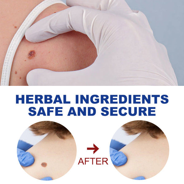 Kayu Liquid Pen Gently Cleanses Skin Care Body Face Label Meat Pellet Kayu Liquid - V.I.P Digital Presence