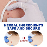 Kayu Liquid Pen Gently Cleanses Skin Care Body Face Label Meat Pellet Kayu Liquid - V.I.P Digital Presence