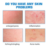 Hyaluronic Acid Face Serum, Moisturizing Repair Lighten Acne Mark Skin Care Whitening Essence - V.I.P Digital Presence