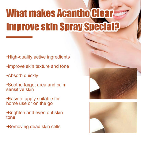 Acantho Clear Improve Skin Spray, Repair Black Spot, Elbow Knee Joint Black Whitening Skin Spray - V.I.P Digital Presence