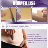 Silicone Scar Patch, Reduces Stretch Marks And Hyperplasia Of Caesarean Section Scars Silicone Patch - V.I.P Digital Presence