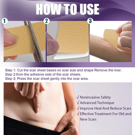 Silicone Scar Patch, Reduces Stretch Marks And Hyperplasia Of Caesarean Section Scars Silicone Patch - V.I.P Digital Presence