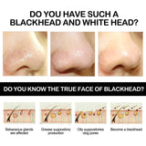 Bamboo Charcoal Blackhead Removing Tearing Facial Mask, Moisturizing Removing Blackhead And Acne Shrinking Pore Oil Control Mud Mask - V.I.P Digital Presence