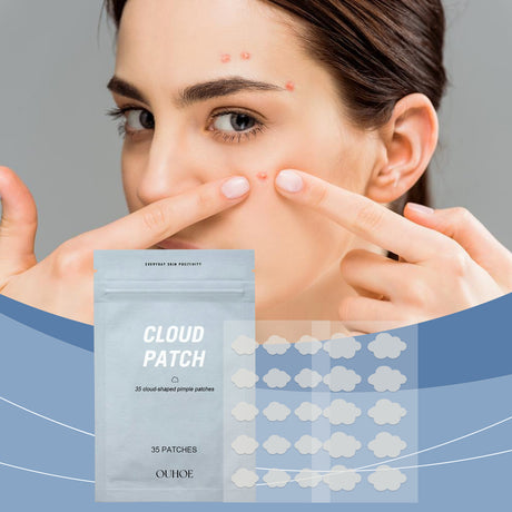 Cloud Acne Patch Repair Mild Facial Skin Clean Acne Skin Delicate Skin Care Patch - V.I.P Digital Presence