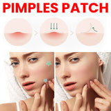 Pimples Patch, Repair Pockmarks Lighten Pimples Blemishes Cover Pimples