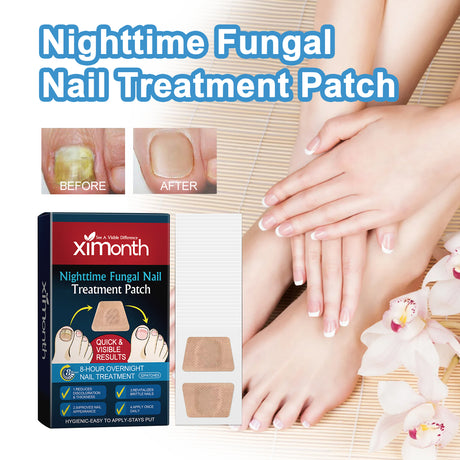 Nighttime Fungal Nail Treatment Patch, Repair Hand And Foot Inlay Rotten Nails Thickening Gray Nail Polish Care Patch - V.I.P Digital Presence
