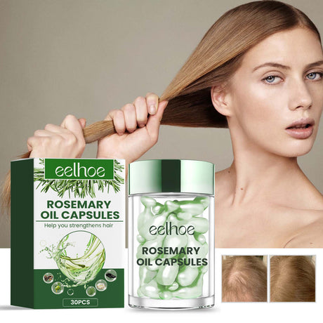 Rosemary Oil Capsules, Nourish Hair Roots Prevent The Loss Of Solid Hair And Hair Moisturizing Hair Care Essential Oil - V.I.P Digital Presence
