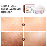 Pigment Repair Cream, Moisturizing And Lightening Freckles Dark Spots Spots Melasma Melanin Beauty Cream - V.I.P Digital Presence