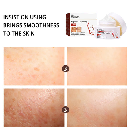 Pigment Repair Cream, Moisturizing And Lightening Freckles Dark Spots Spots Melasma Melanin Beauty Cream - V.I.P Digital Presence