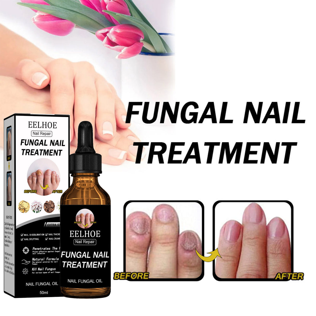 Nail Repair Solution Thickening Brightening Nails Removing Gray Nails Dead Skin Repair Nourishing Nail Care Solution - V.I.P Digital Presence