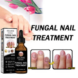 Nail Repair Solution Thickening Brightening Nails Removing Gray Nails Dead Skin Repair Nourishing Nail Care Solution - V.I.P Digital Presence