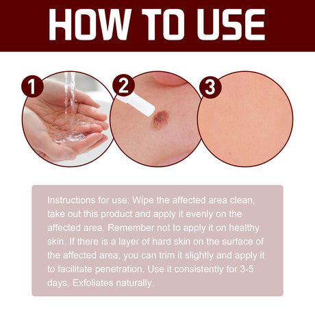 Wart Cream Pen, Skin Tags Gram Warts Fade Moles Corns Smooth Moisturizing Skin Repair - V.I.P Digital Presence