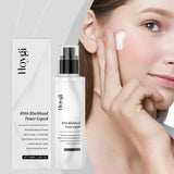 Salicylic Acid Exfoliating Essence Moisturizes Facial Skin Pores, Hydrates And Nourifies - V.I.P Digital Presence