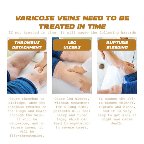 Vein Renewal Smooth Legs Cream, Relief Sore Legs Massage Varicose Earthworm Leg Vein Care Cream - V.I.P Digital Presence